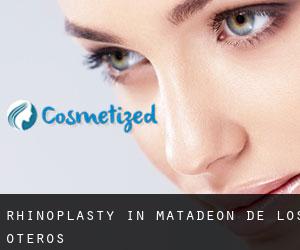 Rhinoplasty in Matadeón de los Oteros