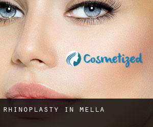 Rhinoplasty in Mella