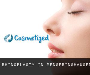 Rhinoplasty in Mengeringhausen