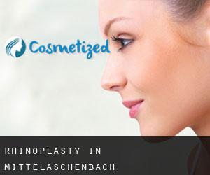 Rhinoplasty in Mittelaschenbach