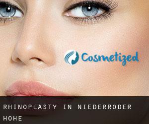 Rhinoplasty in Niederröder Höhe