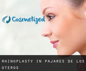 Rhinoplasty in Pajares de los Oteros