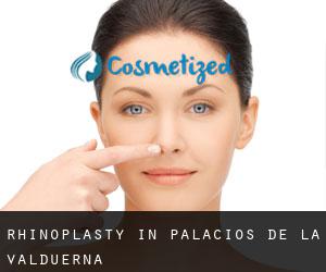 Rhinoplasty in Palacios de la Valduerna