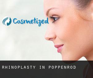 Rhinoplasty in Poppenrod