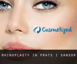 Rhinoplasty in Prats i Sansor