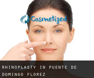 Rhinoplasty in Puente de Domingo Flórez