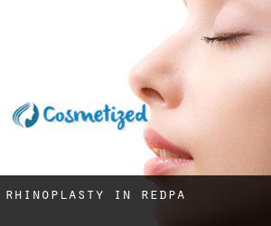 Rhinoplasty in Redpa