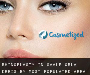 Rhinoplasty in Saale-Orla-Kreis by most populated area - page 1