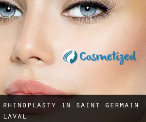 Rhinoplasty in Saint-Germain-Laval