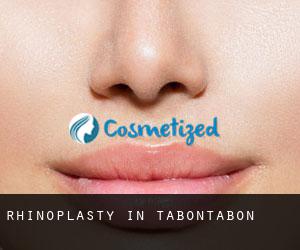 Rhinoplasty in Tabontabon