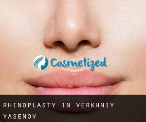 Rhinoplasty in Verkhniy Yasenov