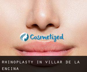 Rhinoplasty in Villar de la Encina