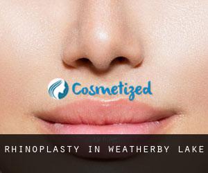 Rhinoplasty in Weatherby Lake