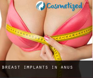 Breast Implants in Anus