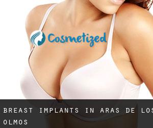 Breast Implants in Aras de los Olmos