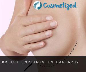 Breast Implants in Cantapoy