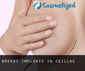 Breast Implants in Ceillac