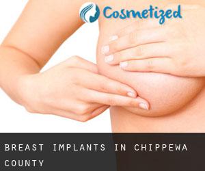 Breast Implants in Chippewa County