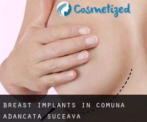Breast Implants in Comuna Adâncata (Suceava)