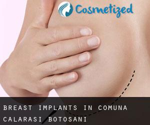 Breast Implants in Comuna Călăraşi (Botoşani)