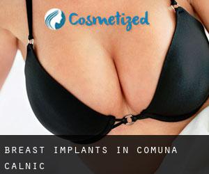 Breast Implants in Comuna Câlnic