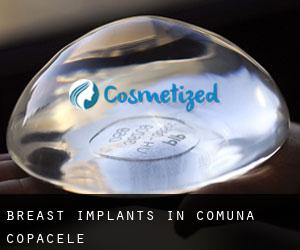 Breast Implants in Comuna Copăcele