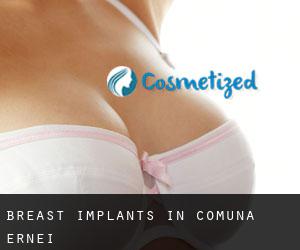 Breast Implants in Comuna Ernei