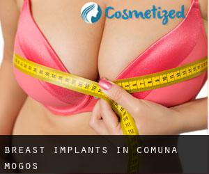 Breast Implants in Comuna Mogoş