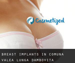 Breast Implants in Comuna Valea Lungă (Dâmboviţa)
