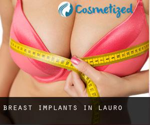 Breast Implants in Lauro