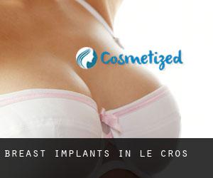 Breast Implants in Le Cros