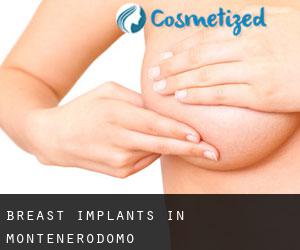 Breast Implants in Montenerodomo