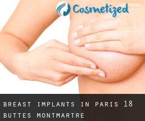 Breast Implants in Paris 18 Buttes-Montmartre