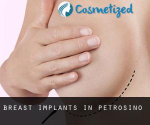 Breast Implants in Petrosino