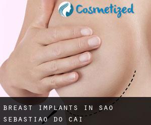 Breast Implants in São Sebastião do Caí