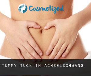 Tummy Tuck in Achselschwang
