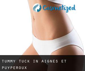 Tummy Tuck in Aignes-et-Puypéroux