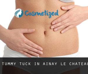 Tummy Tuck in Ainay-le-Château