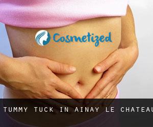 Tummy Tuck in Ainay-le-Château