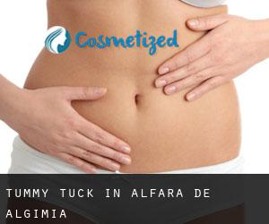 Tummy Tuck in Alfara de Algimia