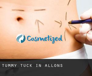 Tummy Tuck in Allons