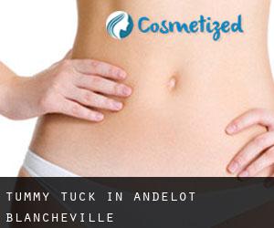 Tummy Tuck in Andelot-Blancheville