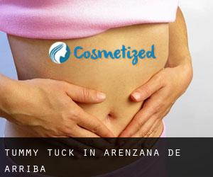 Tummy Tuck in Arenzana de Arriba