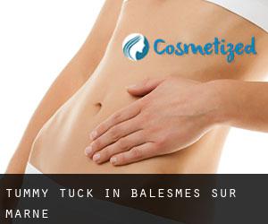 Tummy Tuck in Balesmes-sur-Marne