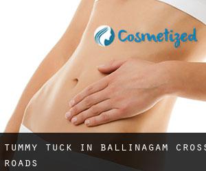 Tummy Tuck in Ballinagam Cross Roads