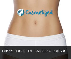 Tummy Tuck in Barotac Nuevo