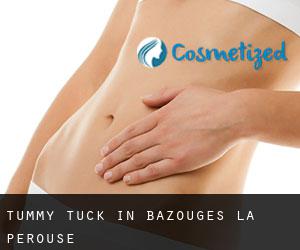 Tummy Tuck in Bazouges-la-Pérouse