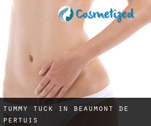 Tummy Tuck in Beaumont-de-Pertuis