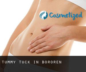 Tummy Tuck in Bororen