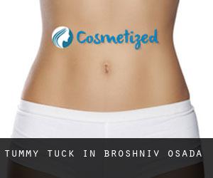 Tummy Tuck in Broshniv-Osada